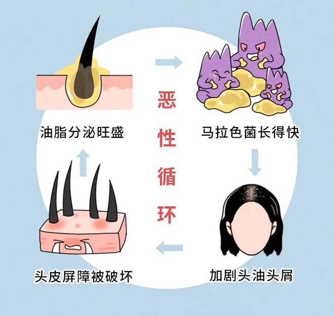 洗头不洗这里？难怪你的头发越来越油(图1)