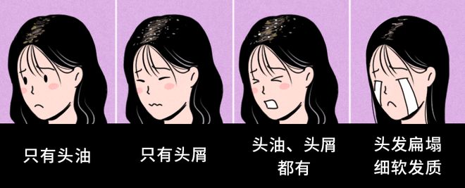 洗头不洗这里？难怪你的头发越来越油(图6)